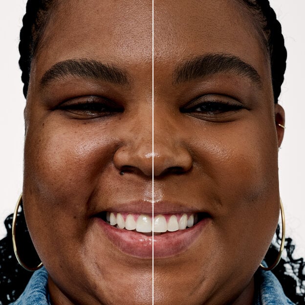 Before and After model shade 32