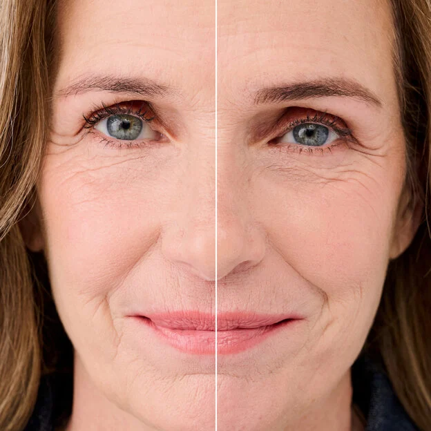 Model before and after application shade 3.5