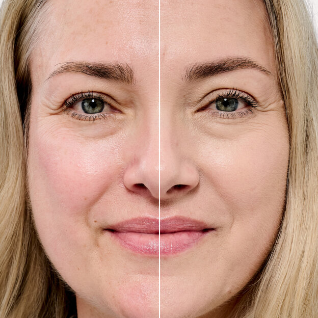 Before and After model shade 7