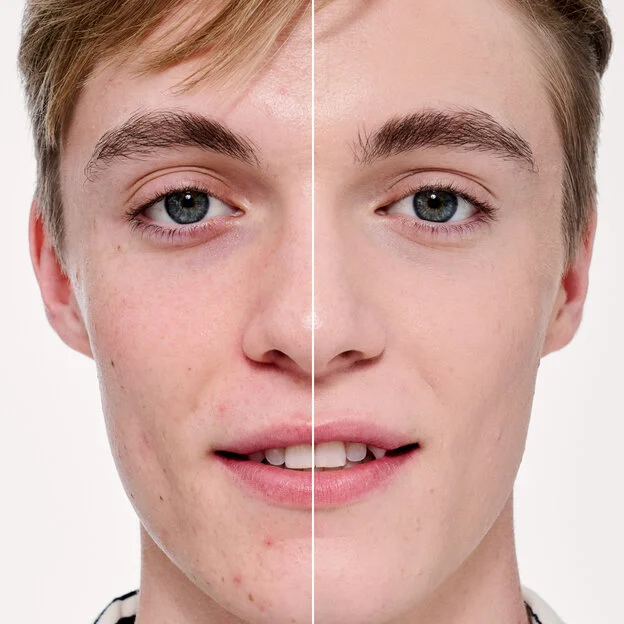 Before and After model shade 5