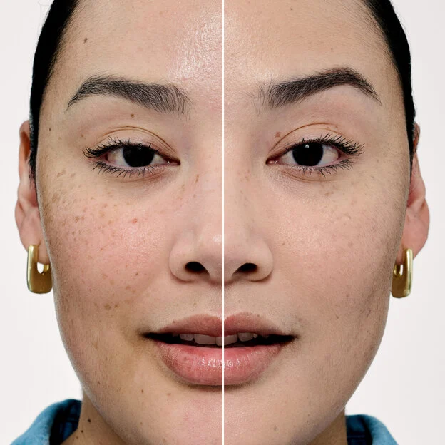 Before and After model shade 10