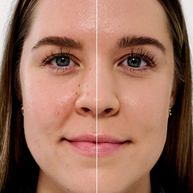 Before and After model shade 6