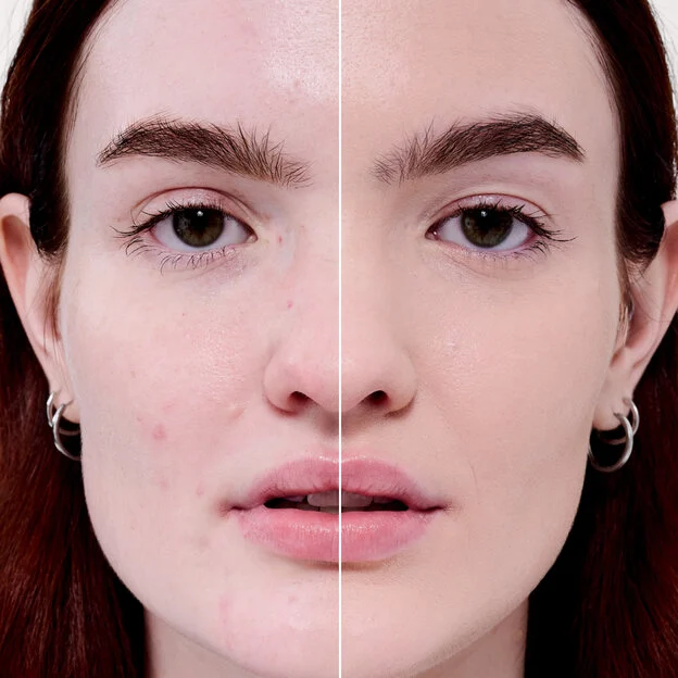 Before and After model shade 1