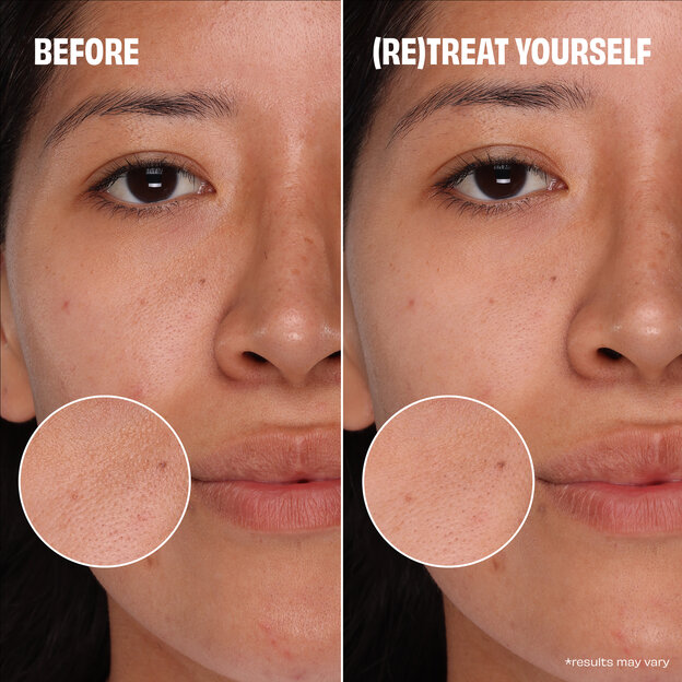 The POREfessional All Clear