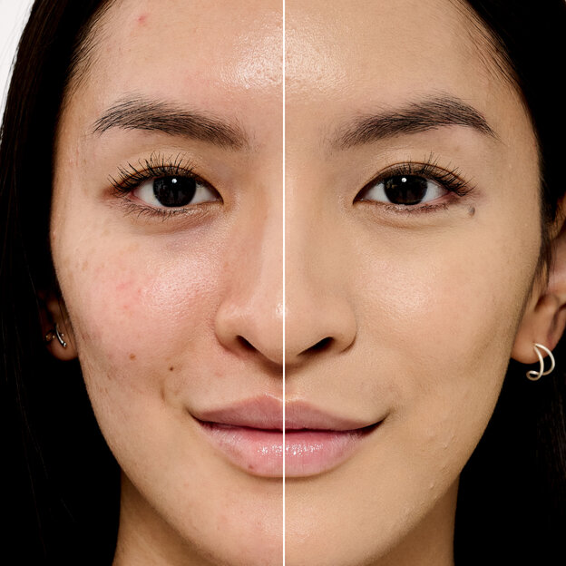 Before and After model shade 11