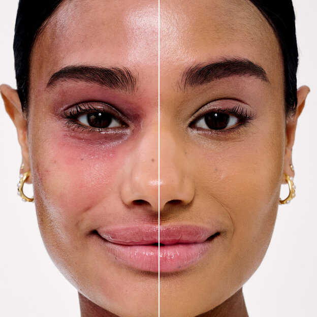 Before and After model shade 24