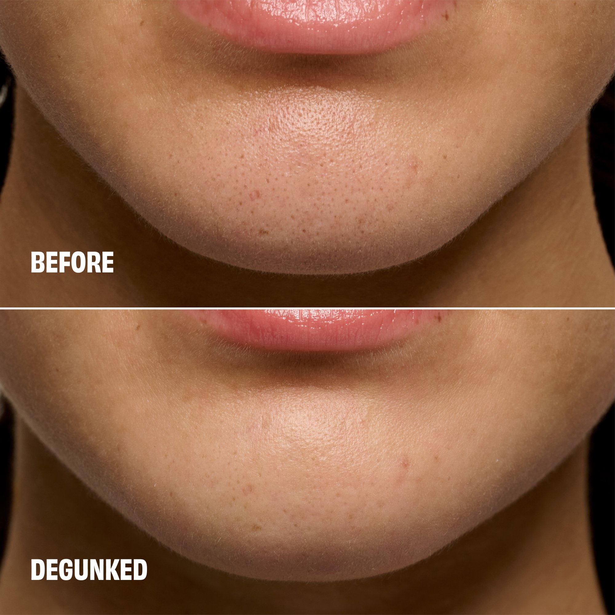 The Porefessional Degunker